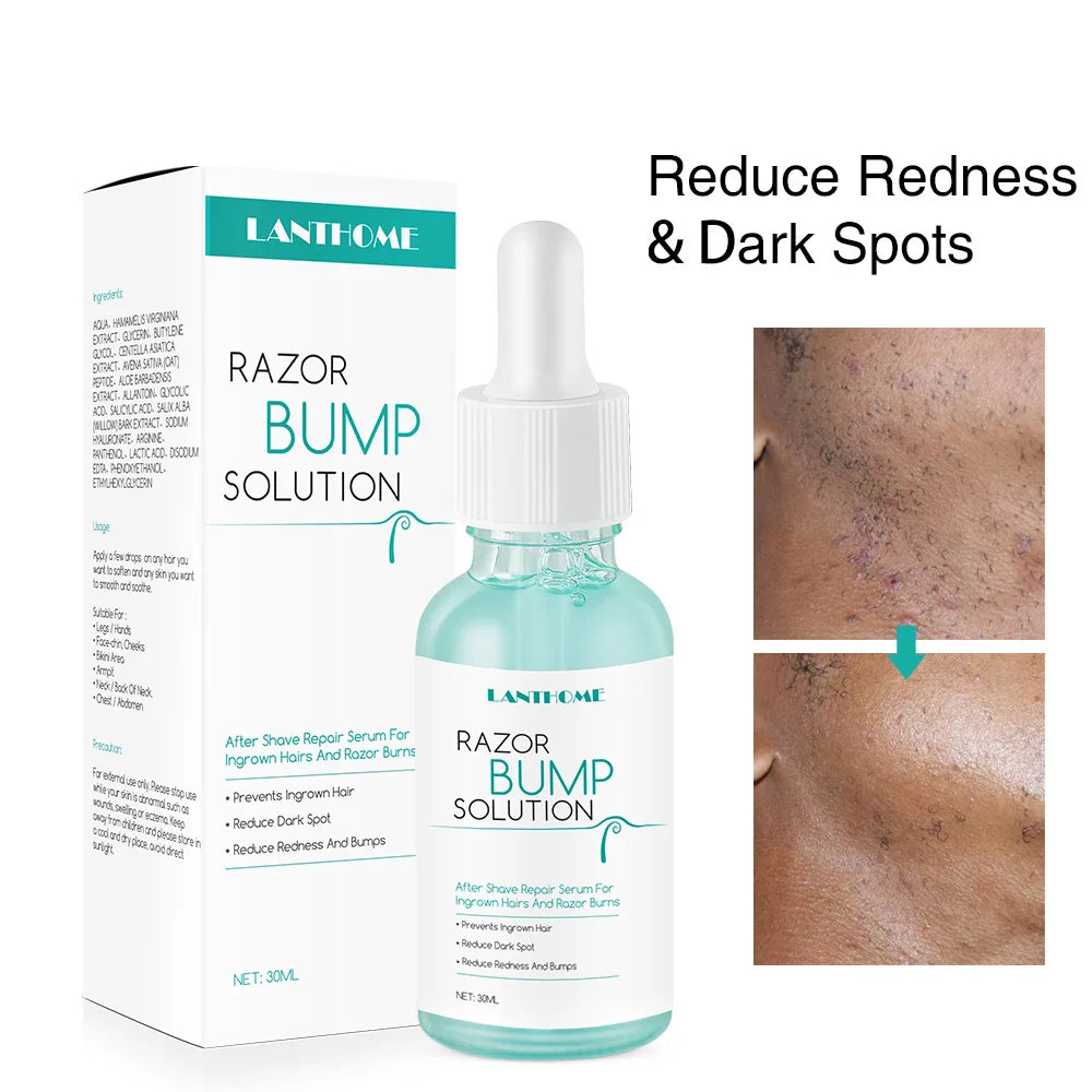 Prevent the Growth of Essence in the Hair, Mildly Moisturize,Prevents I Ngrown Hair Oil,Painless Hair Removal Oil